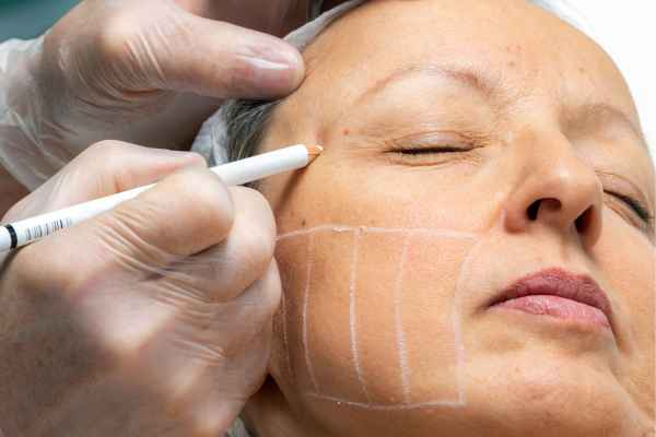 CryoPen: 5 Skin Concerns It May Be Used to Treat 4 What should you ask before having CryoPen treatment Kenilworth?