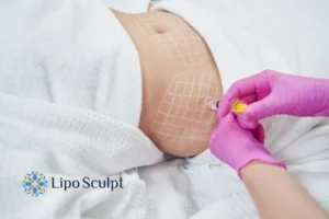 Are The Results From Aqualyx Permanent? 1 Do you want to know how long Aqualyx Kenilworth results last?