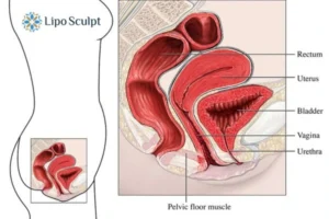 Treatment For A Leaky Bladder 2 How EM Chair treatment Kenilworth can help Leaky bladder issues. Read more now!