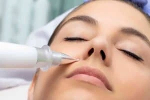 Best Actinic Keratoses Removal 3 Actinic keratoses Kenilworth solutions - book in today!