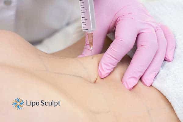 Aqualyx for Muffin Tops: What to Know Before Fat-Dissolving Injections 4 Are there risks Kenilworth?