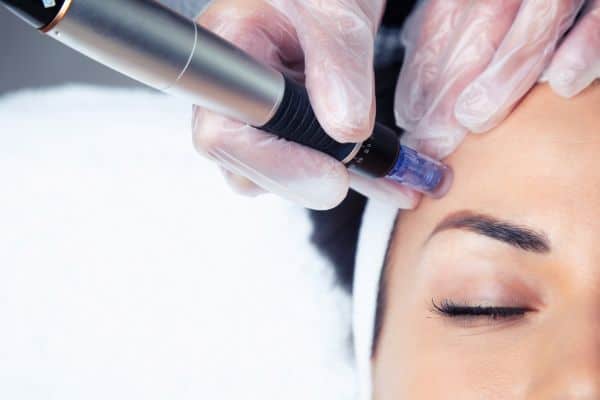 Explaining Total Skin Tightening Treatment and What to Expect 2 What Skin Concerns Can Total Skin Tightening Treatment Help With Kenilworth?